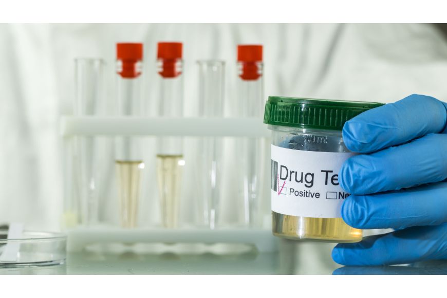10 Medications That Can Cause False Positive Drug Tests | America’s Pharmacy 10 Medications That Can Cause False Positive Drug Tests | America’s Pharmacy